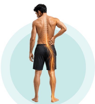 Illustration of spinal nerves highlighting nerve-related pain treated with spinal decompression