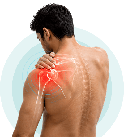 Illustration of the shoulder joint highlighting areas treated with ultrasound therapy