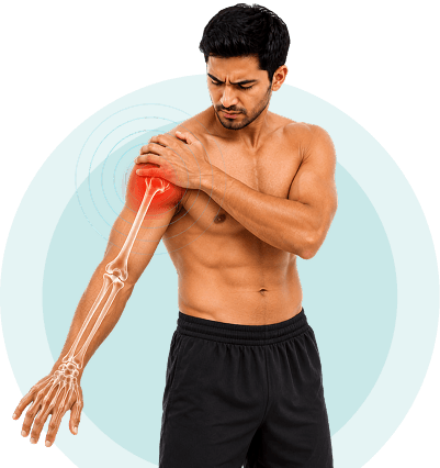 Illustration of the arm and hand highlighting swelling areas treated with compression therapy