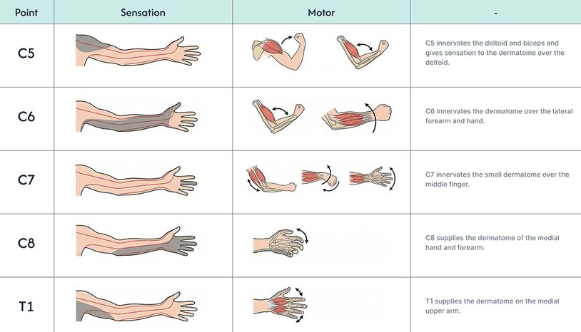 Chart of cervical nerves C5 to T1 showing the sensation areas and motor functions each nerve controls in the arm and hand