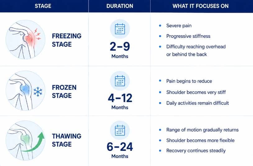Infographic of the three frozen shoulder stages showing duration and focus for the freezing, frozen and thawing stages