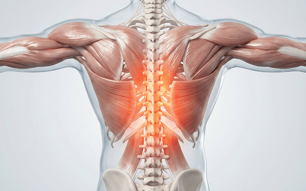 3D anatomy illustration of the back muscles and spine with highlighted pain area