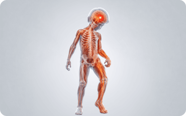 3D illustration of a child's nervous system highlighting how cerebral palsy affects movement