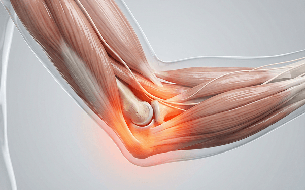 3D anatomy illustration of the elbow tendons and muscles with highlighted pain area