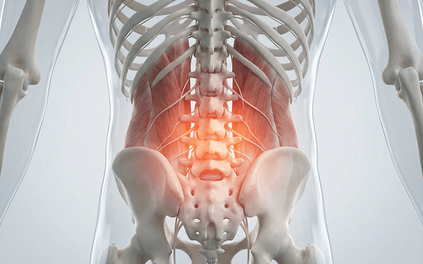 3D anatomy illustration of the lower back spine and muscles with highlighted pain area