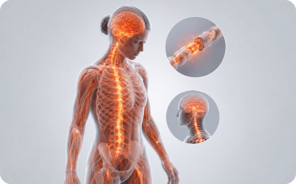 3D illustration of the brain, spinal cord and nervous system highlighting affected neural pathways in Multiple Sclerosis
