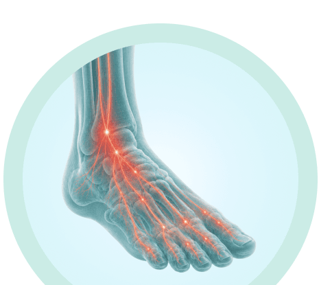 Anatomical illustration showing peripheral neuropathy rehab, area