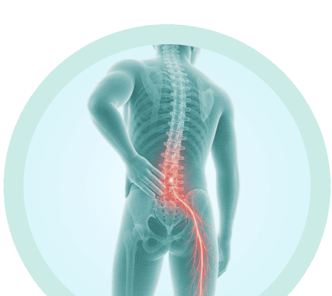 Anatomical illustration showing slip disc relief, area
