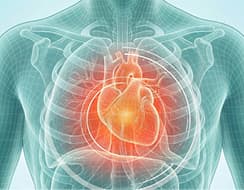 Cardiac & Cardiopulmonary Care