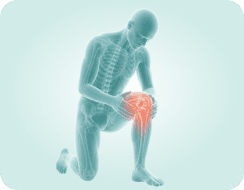 Knee Osteoarthritis