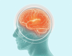 Neurological